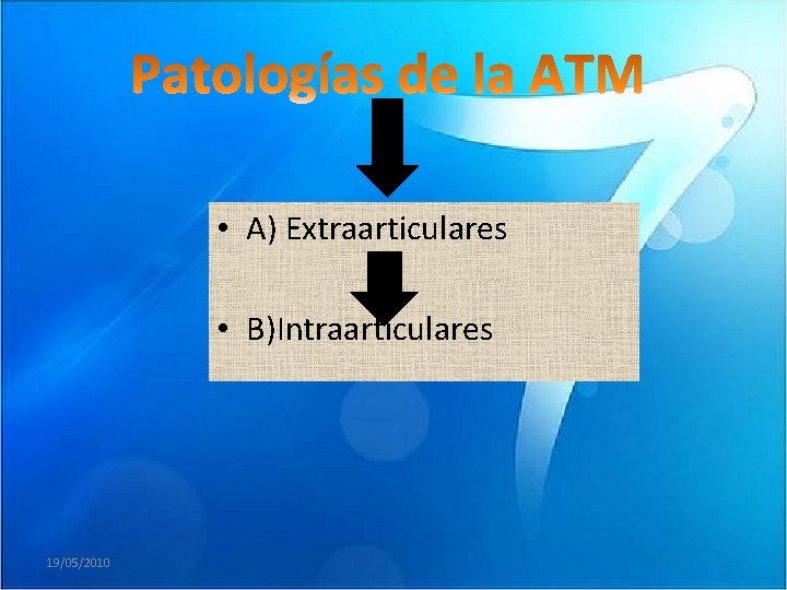  • A) Extraarticulares • B)Intraarticulares 19/05/2010 