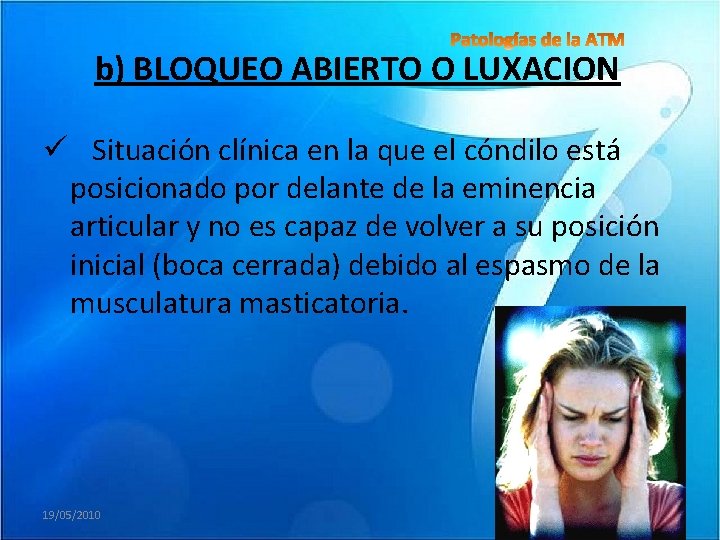 b) BLOQUEO ABIERTO O LUXACION ü Situación clínica en la que el cóndilo está