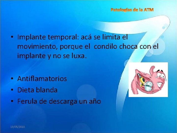  • Implante temporal: acá se limita el movimiento, porque el condilo choca con