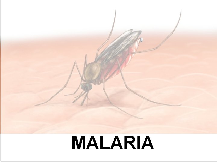 MALARIA 