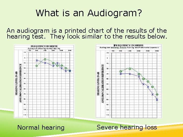 What is an Audiogram? An audiogram is a printed chart of the results of