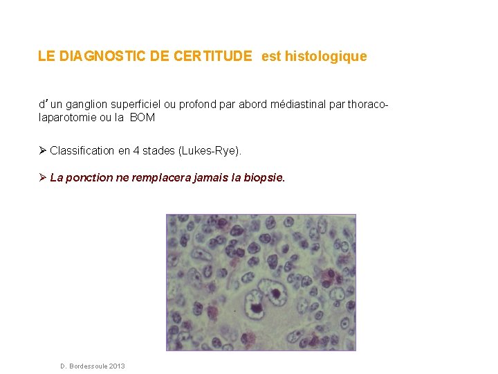 LE DIAGNOSTIC DE CERTITUDE est histologique d’un ganglion superficiel ou profond par abord médiastinal LE DIAGNOSTIC DE CERTITUDE est histologique d’un ganglion superficiel ou profond par abord médiastinal