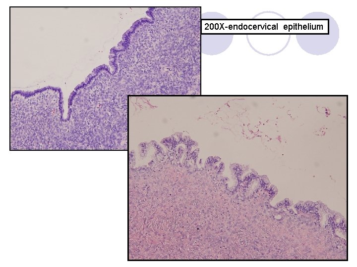 200 X-endocervical epithelium 