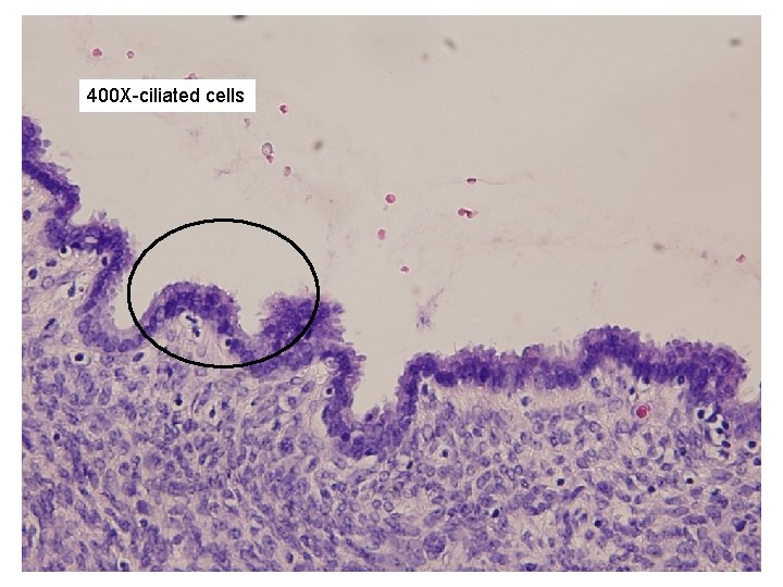 400 X-ciliated cells 