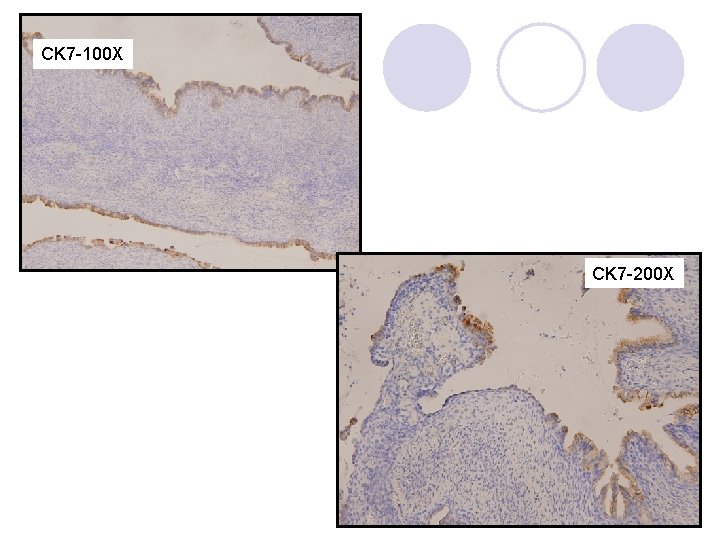 CK 7 -100 X CK 7 -200 X 