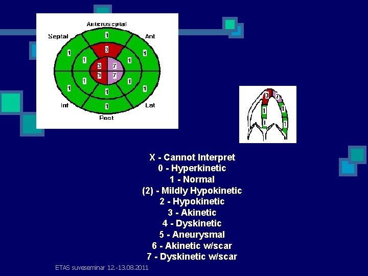 X - Cannot Interpret 0 - Hyperkinetic 1 - Normal (2) - Mildly Hypokinetic