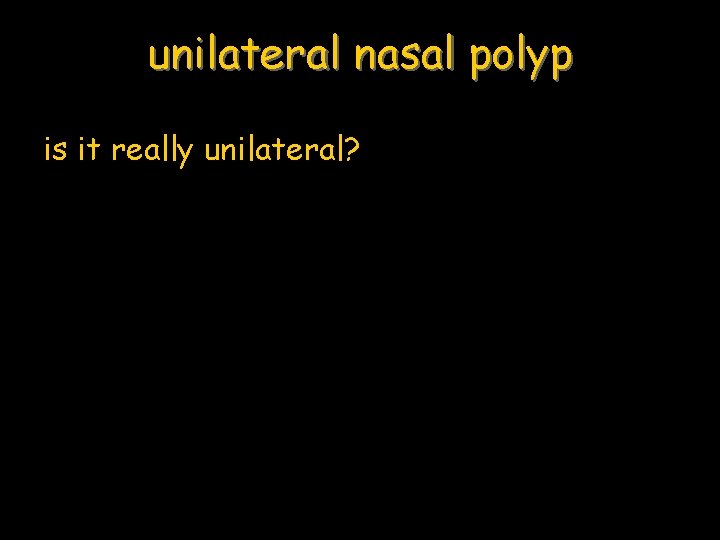 unilateral nasal polyp is it really unilateral? 