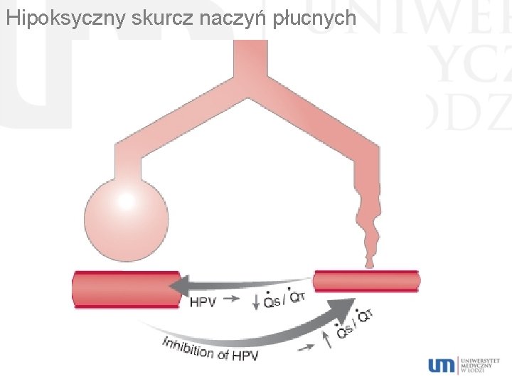 Hipoksyczny skurcz naczyń płucnych 