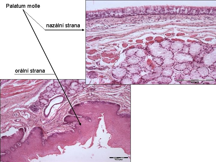 Palatum molle nazální strana orální strana 