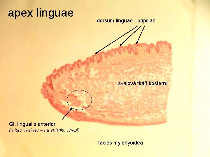 apex linguae dorsum linguae - papillae svalová tkáň kosterní Gl. lingualis anterior (místo výskytu