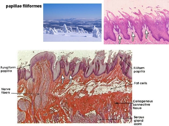 papillae filiformes 