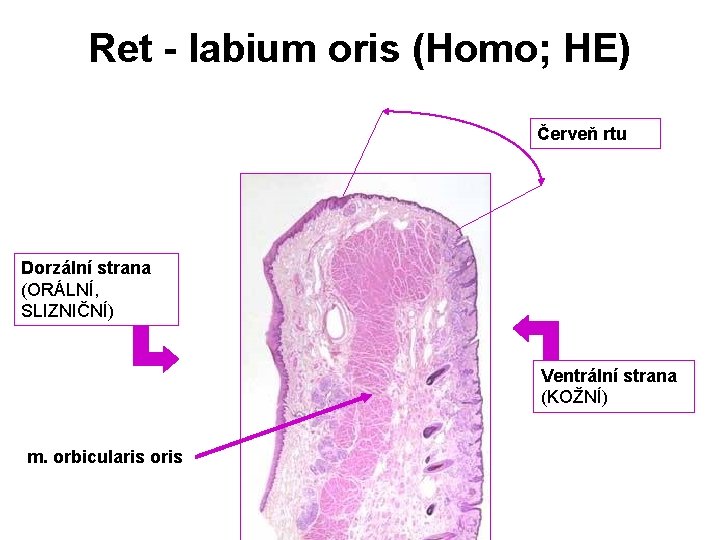 Ret - labium oris (Homo; HE) Červeň rtu Dorzální strana (ORÁLNÍ, SLIZNIČNÍ) Ventrální strana