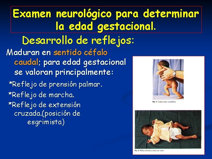 Examen neurológico para determinar la edad gestacional. Desarrollo de reflejos: Maduran en sentido céfalo