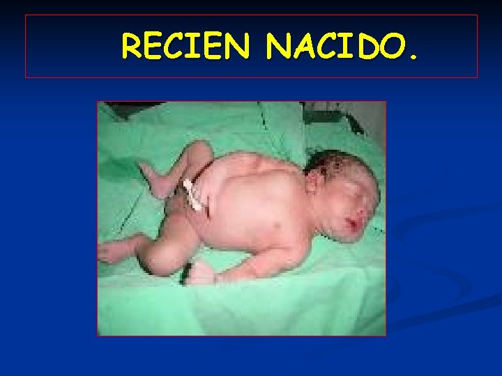 RECIEN NACIDO. 