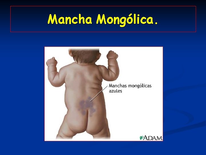 Mancha Mongólica. 