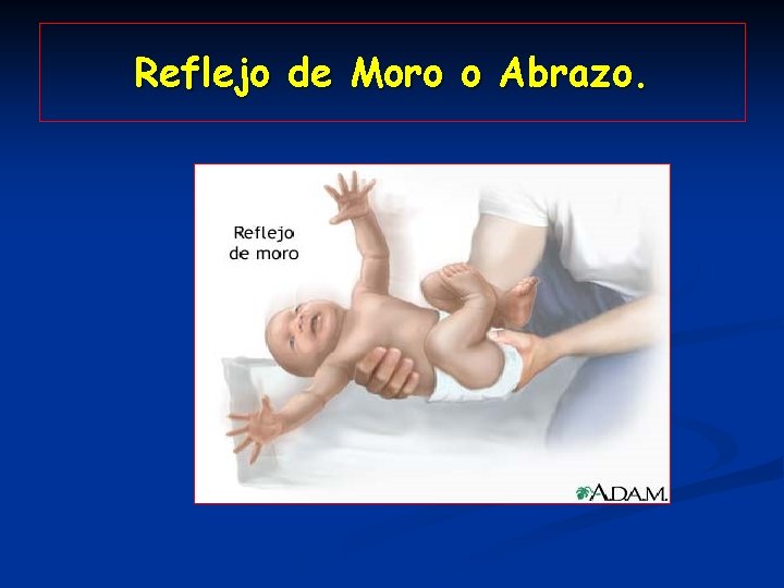 Reflejo de Moro o Abrazo. 