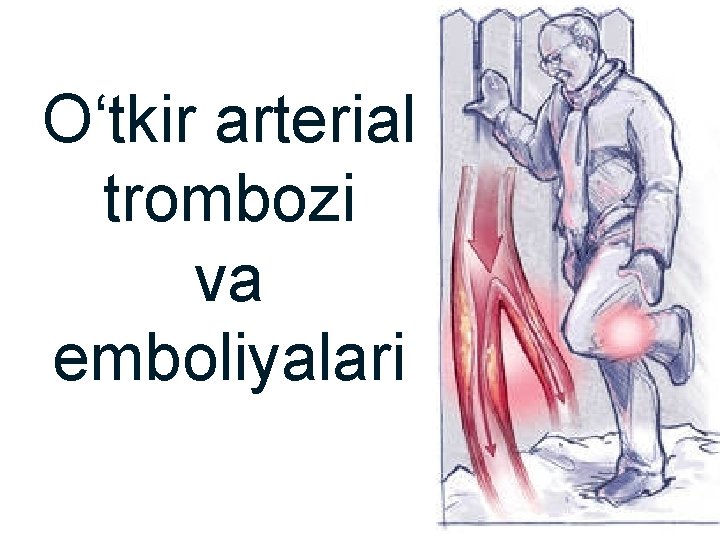 O‘tkir arterial trombozi va emboliyalari 