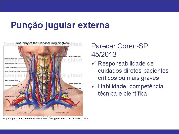 Punção jugular externa Parecer Coren-SP 45/2013 ü Responsabilidade de cuidados diretos pacientes críticos ou