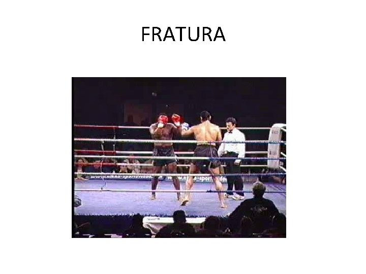 FRATURA 