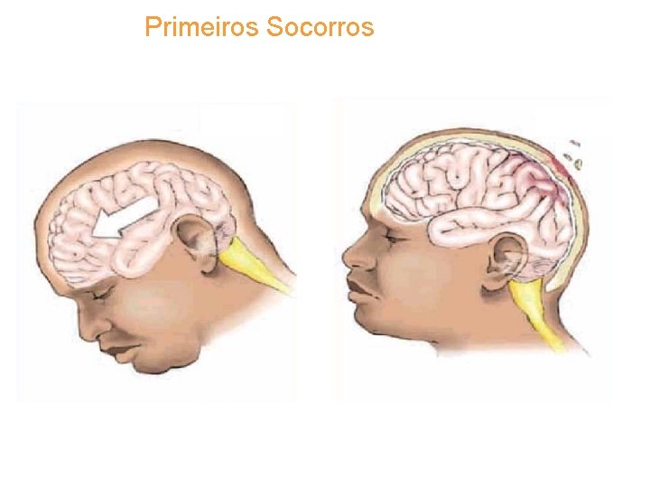 Primeiros Socorros 