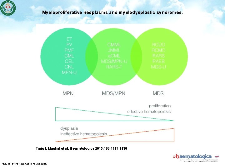 Myeloproliferative neoplasms and myelodysplastic syndromes. Tariq I. Mughal et al. Haematologica 2015; 100: 1117