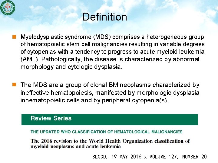 Definition n Myelodysplastic syndrome (MDS) comprises a heterogeneous group of hematopoietic stem cell malignancies