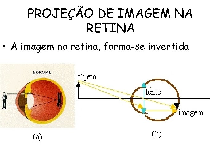 PROJEÇÃO DE IMAGEM NA RETINA • A imagem na retina, forma-se invertida 