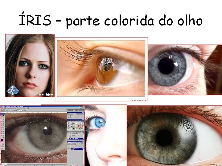 ÍRIS – parte colorida do olho 