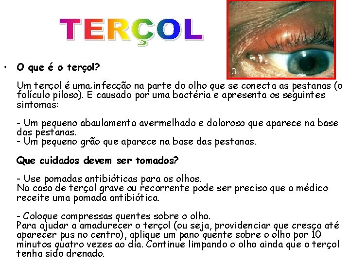  • O que é o terçol? Um terçol é uma infecção na parte