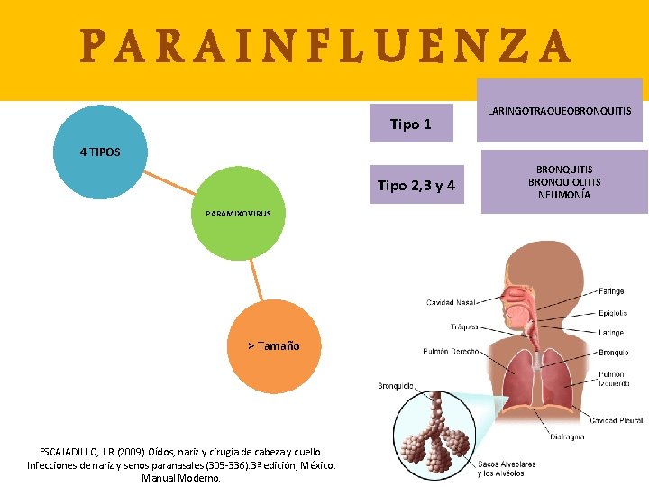 PARAINFLUENZA Tipo 1 LARINGOTRAQUEOBRONQUITIS 4 TIPOS Tipo 2, 3 y 4 PARAMIXOVIRUS > Tamaño