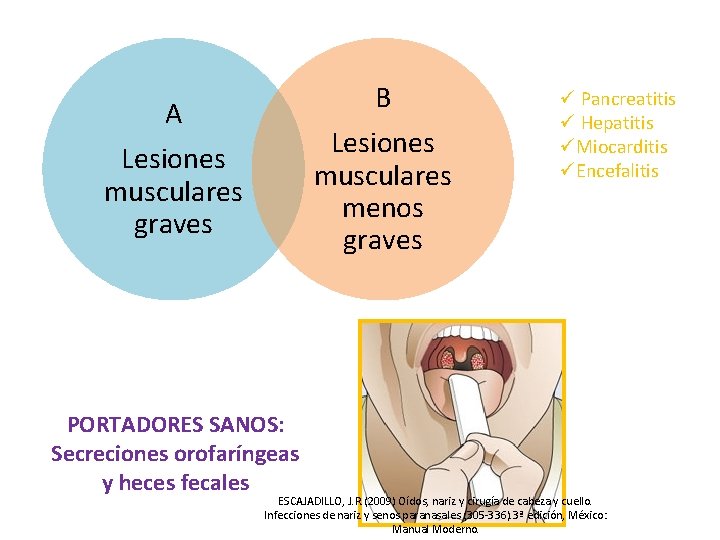 B Lesiones musculares menos graves A Lesiones musculares graves PORTADORES SANOS: Secreciones orofaríngeas y
