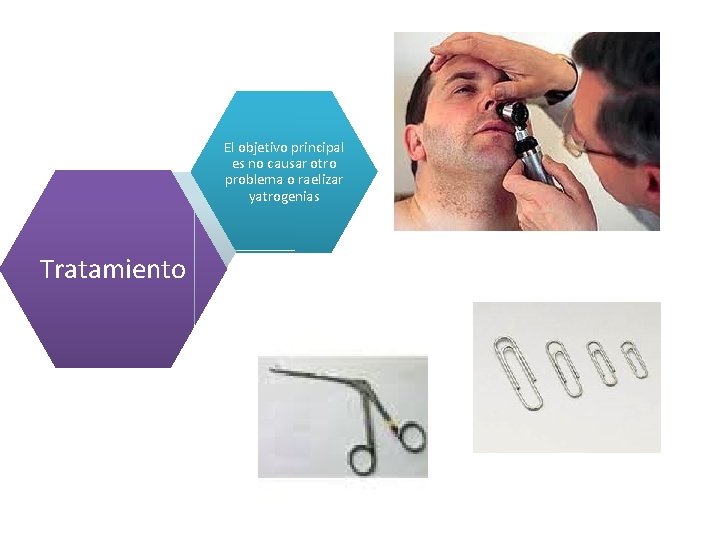 El objetivo principal es no causar otro problema o raelizar yatrogenias Tratamiento 