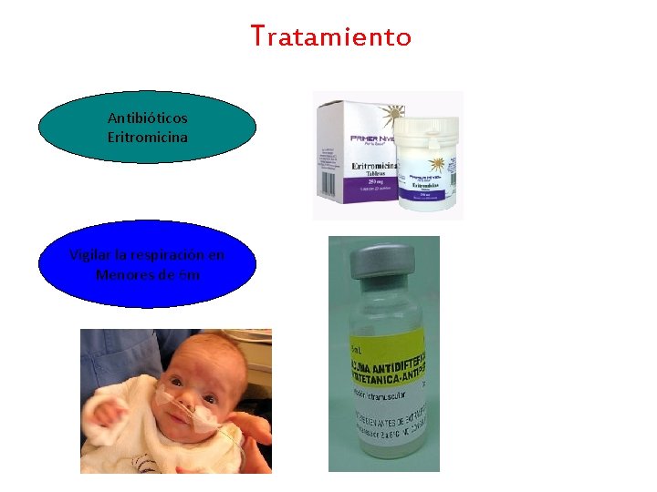 Tratamiento Antibióticos Eritromicina Vigilar la respiración en Menores de 6 m 
