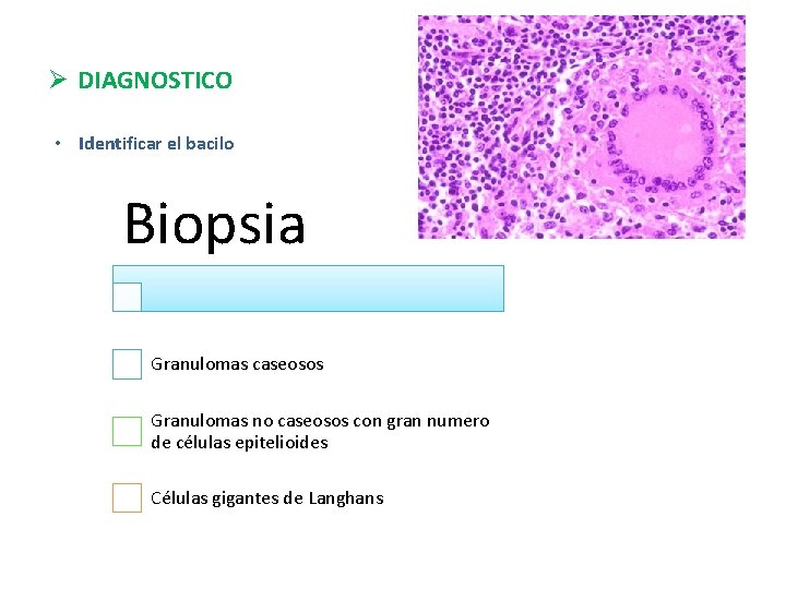 Ø DIAGNOSTICO • Identificar el bacilo Biopsia Granulomas caseosos Granulomas no caseosos con gran