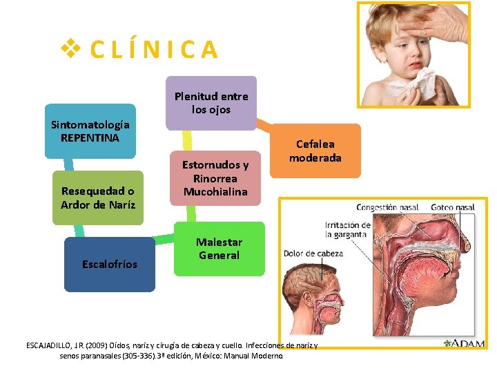 v. CLÍNICA Sintomatología REPENTINA Resequedad o Ardor de Naríz Escalofríos Plenitud entre los ojos