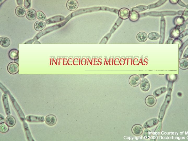 INFECCIONES MICOTICAS 