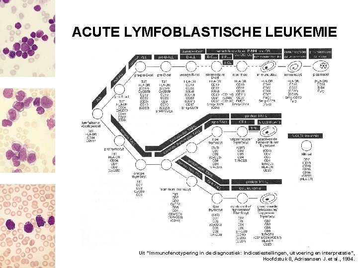 ACUTE LYMFOBLASTISCHE LEUKEMIE Uit “Immunofenotypering in de diagnostiek: Indicatiestellingen, uitvoering en interpretatie”, Hoofdstuk 8,