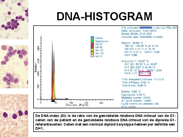 DNA-HISTOGRAM De DNA-index (DI) is de ratio van de gemiddelde relatieve DNA-inhoud van de