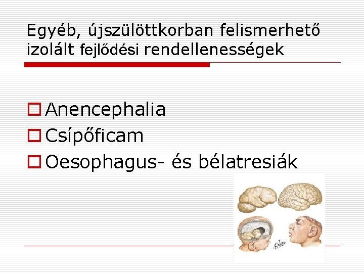 Egyéb, újszülöttkorban felismerhető izolált fejlődési rendellenességek o Anencephalia o Csípőficam o Oesophagus- és bélatresiák