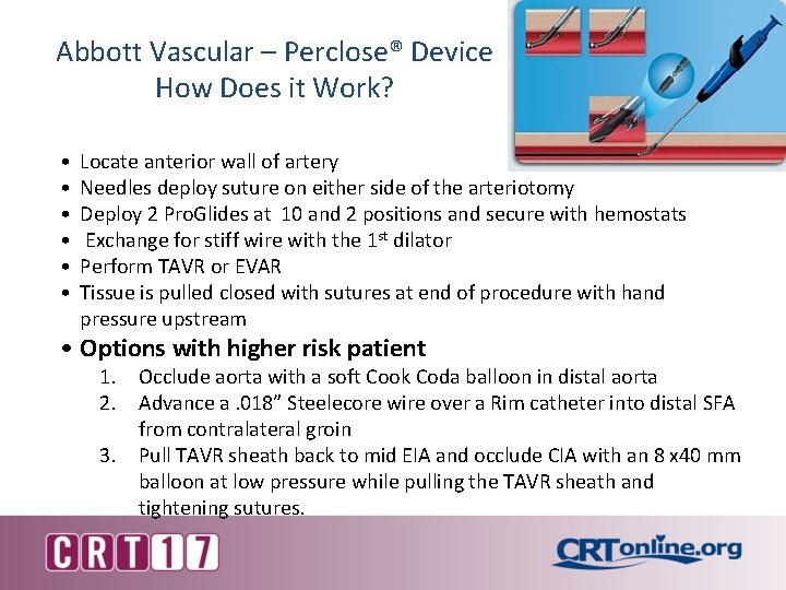 Abbott Vascular – Perclose® Device How Does it Work? • • • Locate anterior