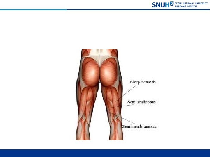 Posterior Femoral Muscle (Hamstrings) 