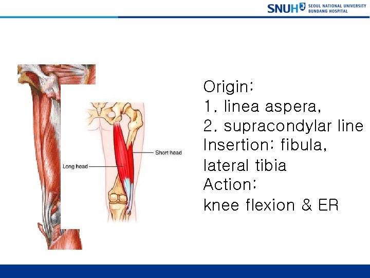 Biceps Femoris (short head) Origin: 1. linea aspera, 2. supracondylar line Insertion: fibula, lateral