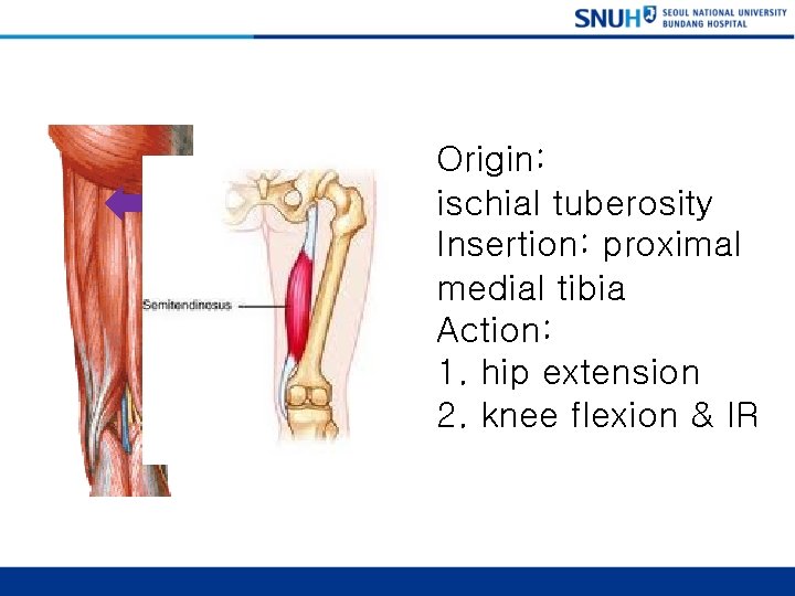 Semitendinosus Origin: ischial tuberosity Insertion: proximal medial tibia Action: 1. hip extension 2. knee