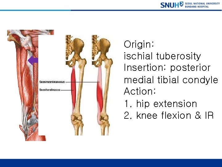 Semimembranosus Origin: ischial tuberosity Insertion: posterior medial tibial condyle Action: 1. hip extension 2.