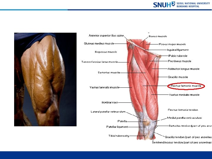 Rectus Femoris muscle 