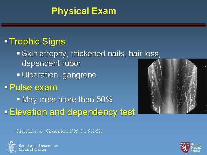 Physical Exam § Trophic Signs § Skin atrophy, thickened nails, hair loss, dependent rubor