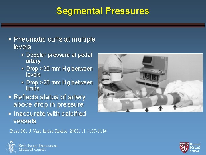 Segmental Pressures § Pneumatic cuffs at multiple levels § Doppler pressure at pedal artery
