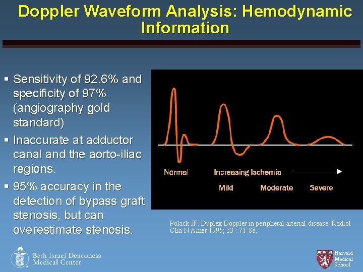 Doppler Waveform Analysis: Hemodynamic Information § Sensitivity of 92. 6% and specificity of 97%