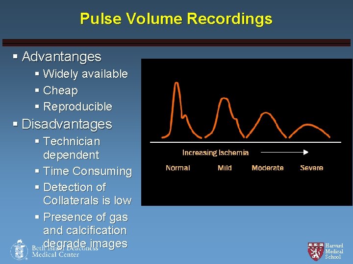 Pulse Volume Recordings § Advantanges § Widely available § Cheap § Reproducible § Disadvantages