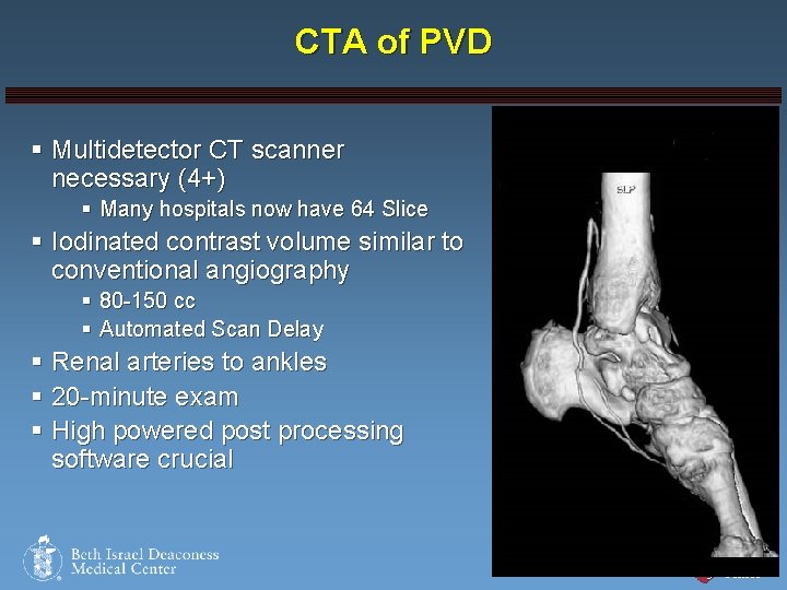 CTA of PVD § Multidetector CT scanner necessary (4+) § Many hospitals now have